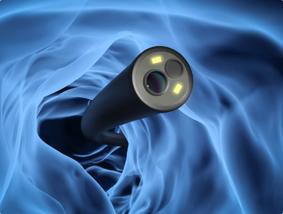 鼹鼠医疗带您了解电子支气管镜的检查流程 鼹鼠医疗带您了解电子支气管镜的检查流程